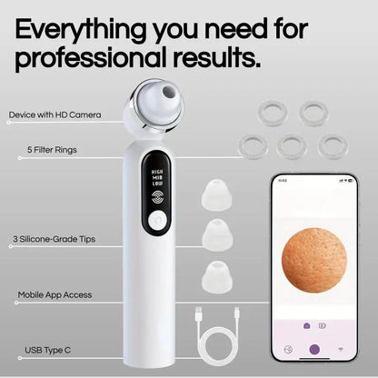 Lumii™- Blackhead Remover