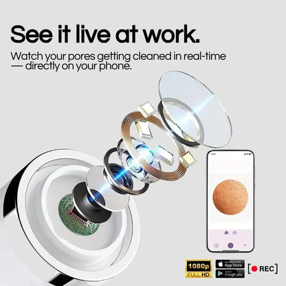 Lumii™- Blackhead Remover