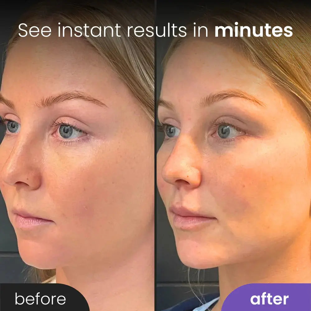 Kevoria™ Beauty Sculptor